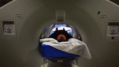 The World S First Total Body PET Scanner Aims EurekAlert