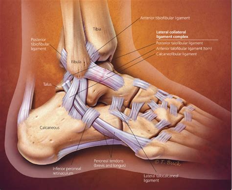 High Ankle Sprain Vs Ankle Sprain Whats The Difference Hss