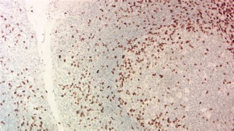 Immunohistochemistry Ihc Stain Purpose Principle And Protocol