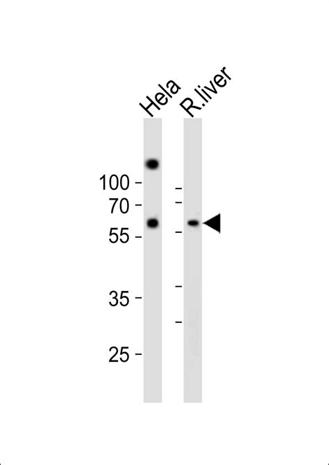 NFIA Antibody C Term Purified Rabbit Polyclonal Antibody Pab WB