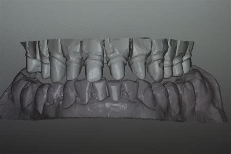 Digital-Line