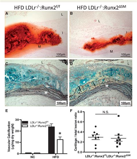 Figure 1 From Runx2 Deletion In Smooth Muscle Cells Inhibits Vascular