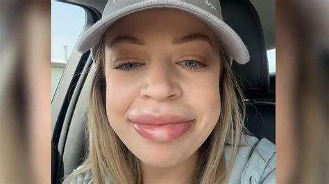 Bonnie Blue Sex Rekord Mit M Nnern Gleichzeitig Hat Folgen Erotikmodel Zeigt Verletzungen