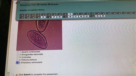 Solved 1 Ascaris Lumbricoides 2 Srongyloides Stercoralis Chegg