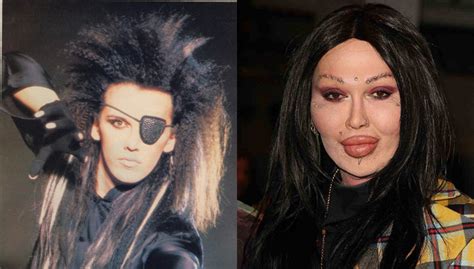 Pete Burns Before And After | Hot Sex Picture