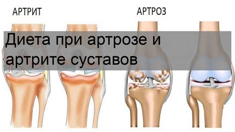 Диета при артрозе и артрите суставов - YouTube