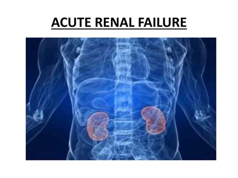 Acute Renal Failure Overview | PPTX | Blood Disorders | Diseases and
