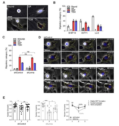 Downregulation Of Lamin A C Does Not Facilitate Melanoma Tem But