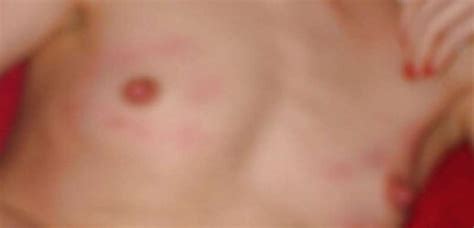 Forceps On My Melons Fervor Gal German Fledgling ZB Porn