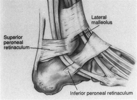 Extensor Retinaculum Of Leg