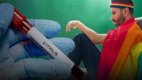 Alaskas Dramatic Syphilis Spike Disproportionately Plagues Gay Bisexual Men Alaska Watchman