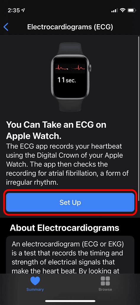 Apple Watch ECG Not Working? Here’s How To Fix It! - The Mac Observer