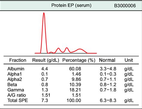 Serum Protein Electrophoresis Procedure, Total Protein,, 54% OFF