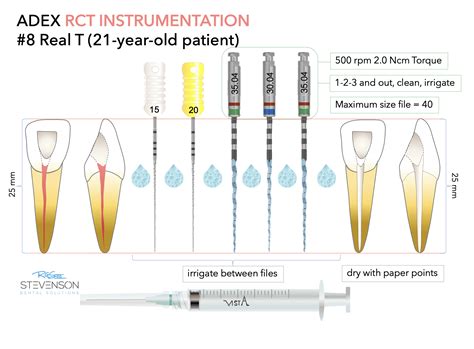 Adex Cdca Exam Dental Course Feb Stevenson Dental Solutions