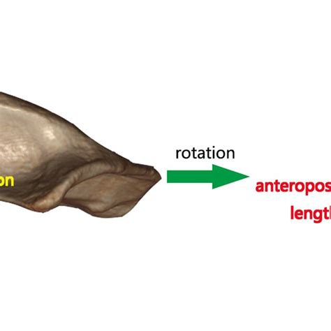 The Adjustment Of The Axial View In The Axial View Of Shoulder Joint