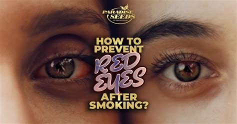 Smoking Weed Before Eye Exam