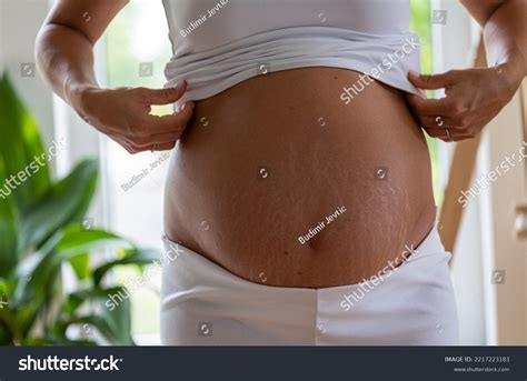 Close Naked Pregnant Woman Belly Stretch Stock Photo 2217223183 Shutterstock