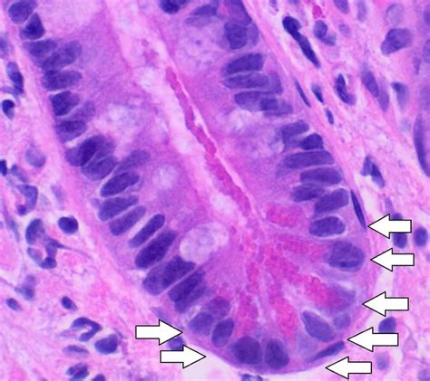 File:Histology of paneth cells, annotated.jpg - HandWiki