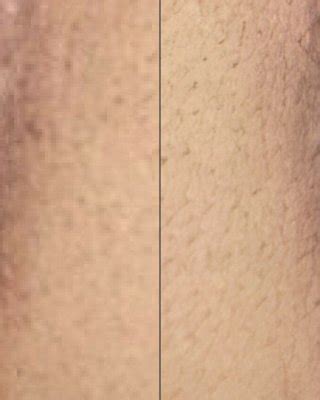 Sophielawson X Nude Porn Pictures XXX Photos Sex Images 4094470 PICTOA