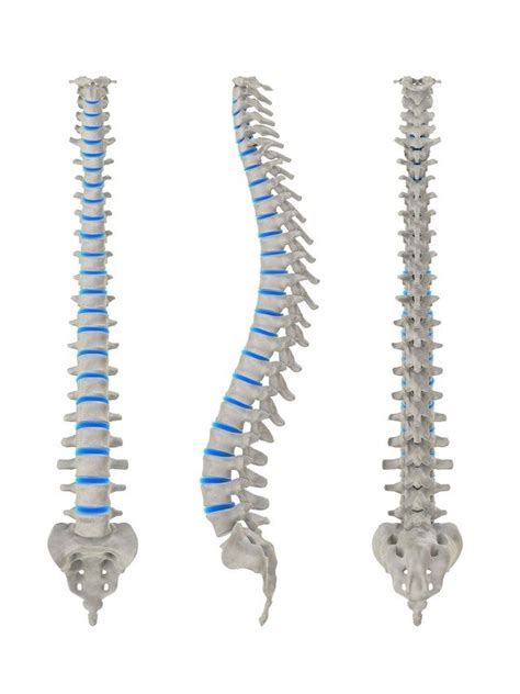 flatback syndrome treatment  delray beach fl fort lauderdale fl