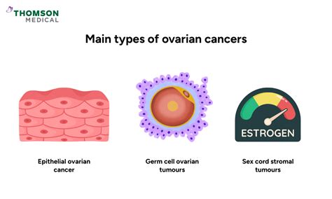 stromal cell ovarian cancer