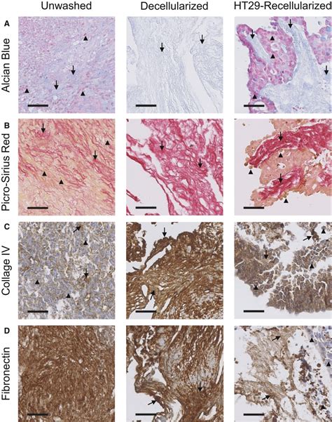 Structural And Compositional Characterization Of Decellularized And