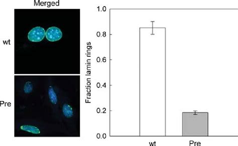 Reduction Of The Number Of Cultured Mefs With Normal Lamin A C Rings