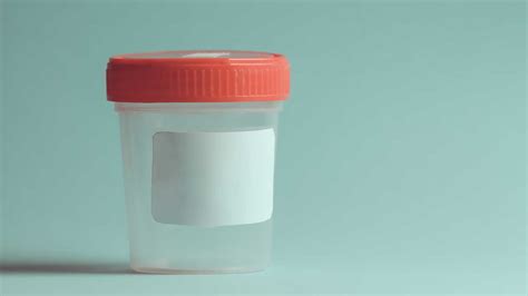 Наистина ли е необходимо да си правя спермограма?