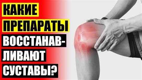 😟 Артроз суставов пальцев рук лечение препараты мази ⚪ Ревматоидный ...