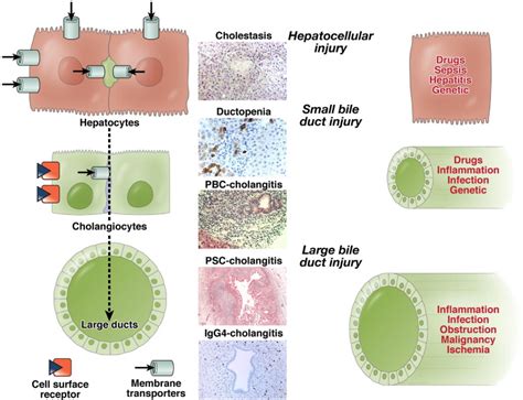 Cholestasis - A Pictures Of Hole 2018