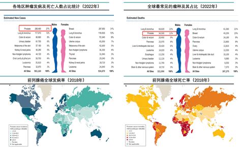 中国前列腺癌五年生存率 664，守住男性生命“腺”！发病率患者治疗