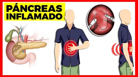 Sintomas De Pancreas Ruim - Sintomas Problema No Pâncreas - NAZAEDU