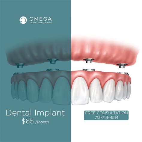 how to get free implants
