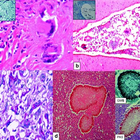 3 Mucorales. (a) Illustration, usual appearance of Mucor spp. (b ...