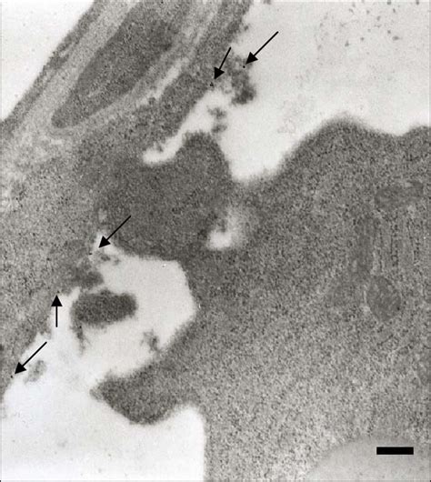 Transmission Electron Microscopy Of Immunogold Labelled Matrix