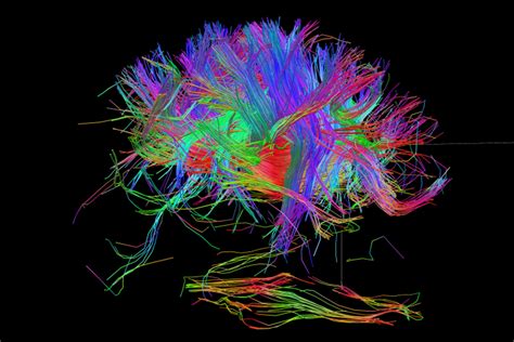 Can we build a complete wiring diagram of the human brain?