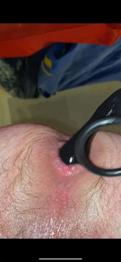 Hitting The Right Spot 15 Nude Pics XHamster