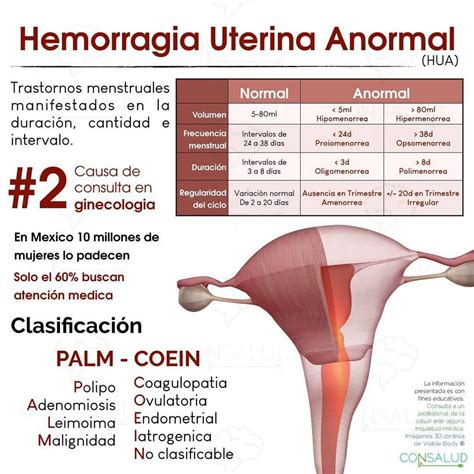 Consalud Enarm En Instagram Flashcards Consalud Hemorragia Uterina