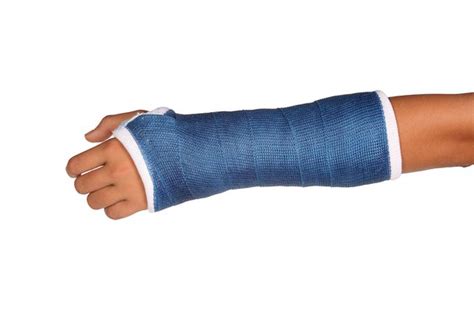 I broke my arm in Spanish | English to Spanish Translation - SpanishDictionary.com