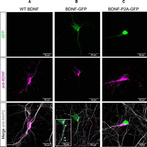 A New Mouse Line Reporting The Translation Of Brain Derived