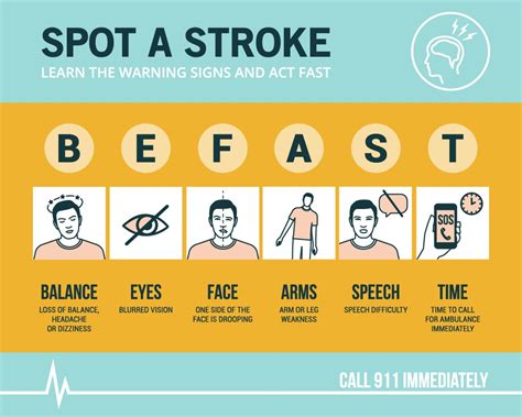 Be Stroke Smart And Be Fast” Alameda Health System