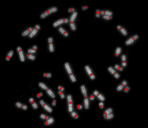 XCE Pan Cen XCyting Centromere Enumeration Probe MetaSystems Probes