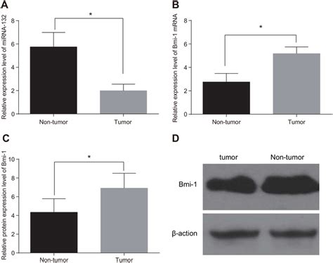 Comparison Of Mir 132 And Bmi 1 Expression In Tumor And Adjacent Normal