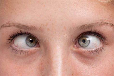 1529 Cross Eyed Stock Photos Free And Royalty Free Stock Photos From