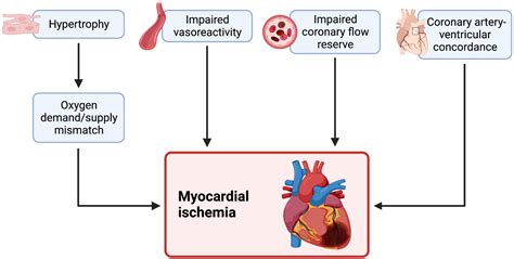 Frontiers Heart Failure In Systemic Right Ventricle Mechanisms And