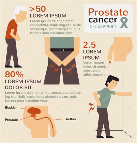 prostate cancer infographics stock vector comzeal