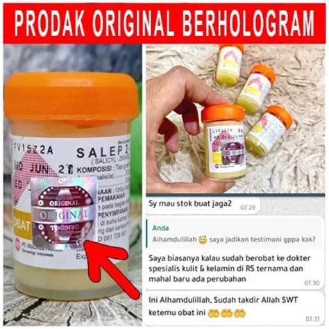 Jual Salep Gatal Zwafel 24 Original 100 Obat Saleb Gatal Panu Kadas