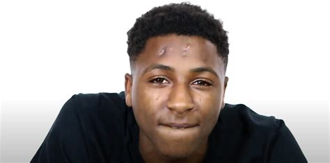 What Happened to NBA Youngboy's Head? Here's How the Rapper Got Those Scars