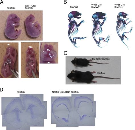 Phenotypes Of Cell Specific Deletion Of Smc3 A An E175 Wnt1 Cre