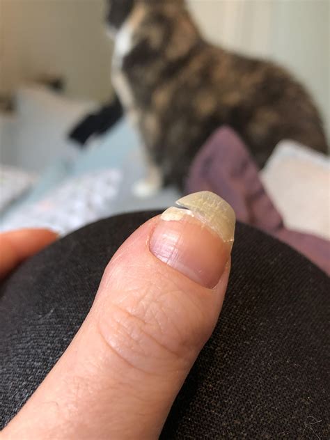 Rip This Is Why You Never Go Out With Naked Nails R Redditlaqueristas